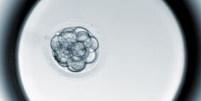 Time Lapse zur Embryobeobachtung